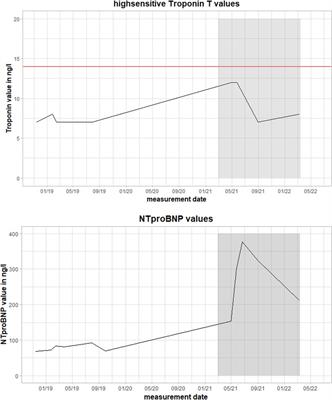 Case report: Recurrence of inflammatory cardiomyopathy detected by magnetocardiography